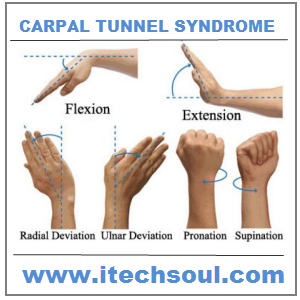 Exercises For Carpal Tunnel Syndrome Relief Pdf