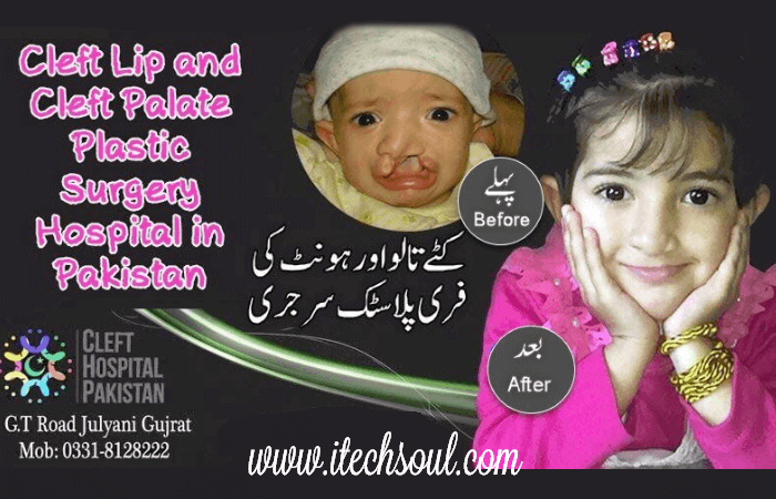 Cleft Lip and Cleft Palate Plastic Surgery Hospital