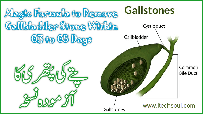 Magic Formula to Remove Gallbladder Stone